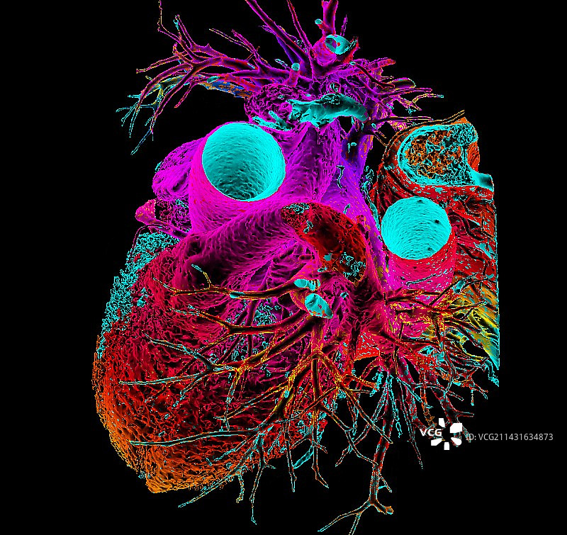 正常人类心脏的3D CT扫描图片素材