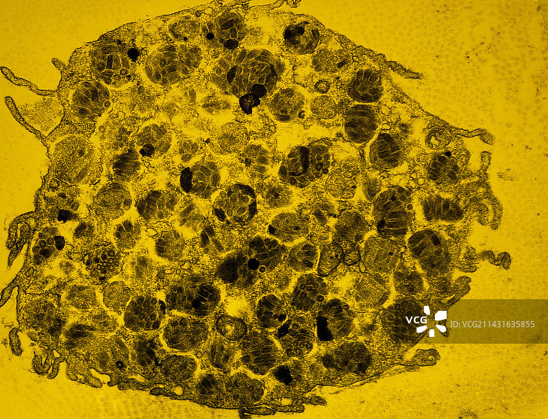 人肥大细胞的假彩色透射电镜图图片素材