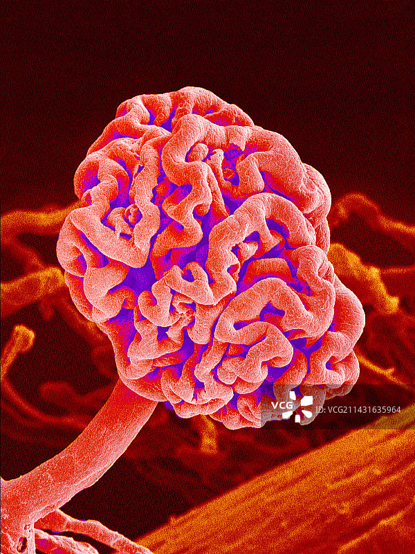 肾小球扫描电镜图图片素材