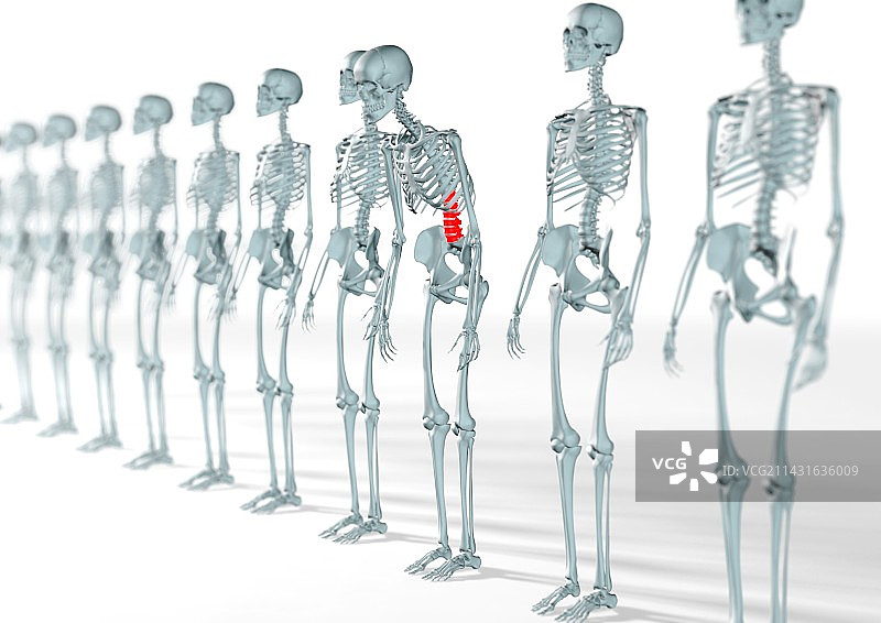 背部疼痛图片素材