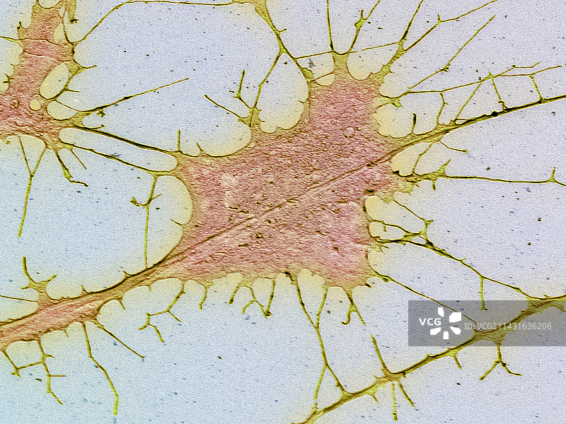 神经细胞培养扫描电镜图图片素材