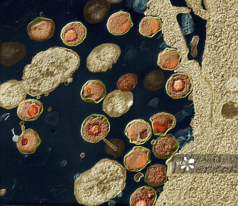 沙眼衣原体细菌，透射电镜图片素材