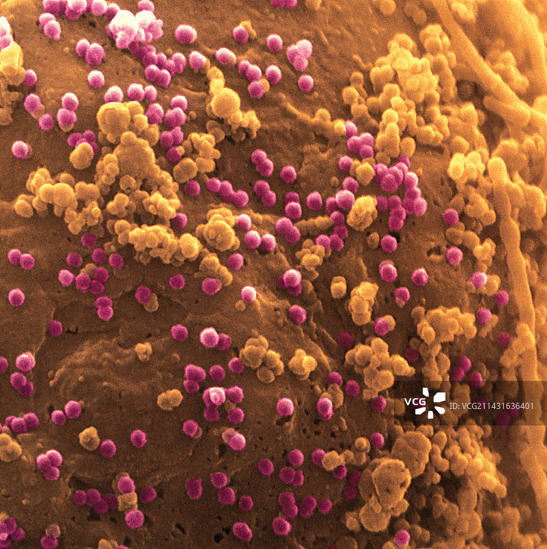 带有HIV的T细胞表面的彩色扫描电镜图像图片素材