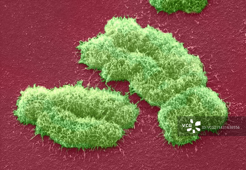 人类染色体，扫描电镜图图片素材