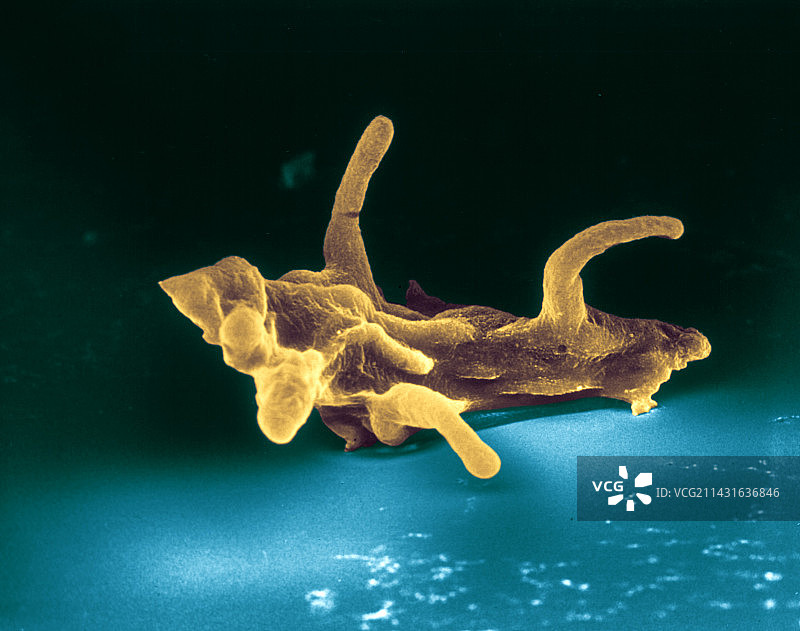 变形虫的彩色扫描电镜图图片素材
