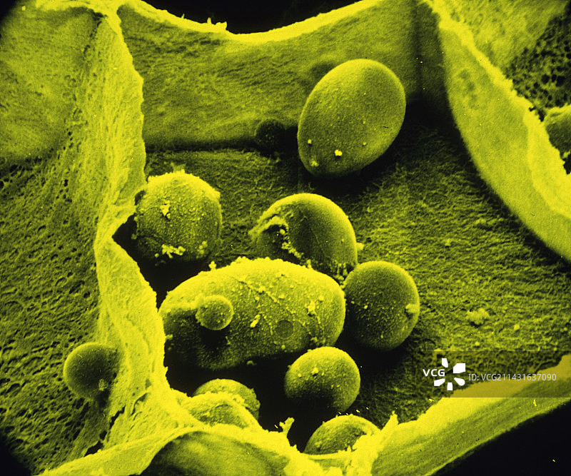 显示淀粉的破损的马铃薯细胞图片素材