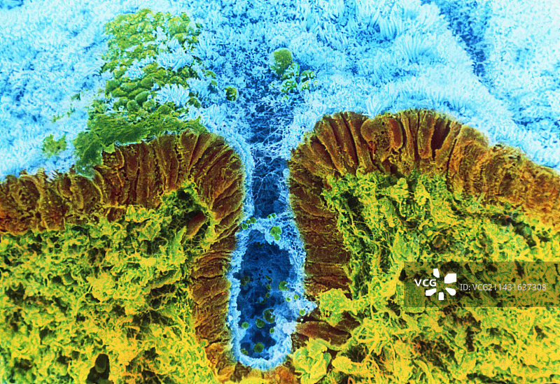 子宫壁（分泌中期）的彩色扫描电镜图图片素材