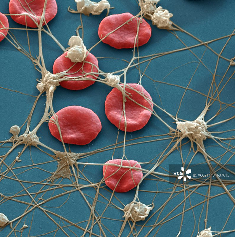 血栓扫描电镜图片素材