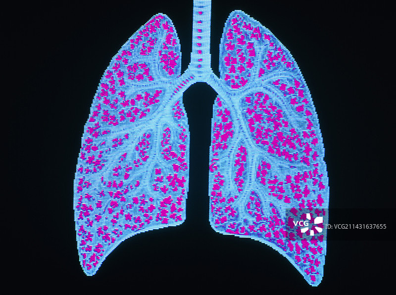 人类肺部、气管和细支气管插画图片素材