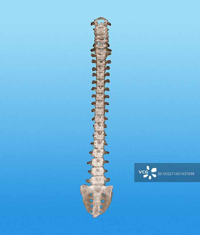 健康的脊柱彩色X光片图片素材