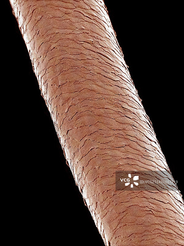 人类头发扫描电镜图图片素材