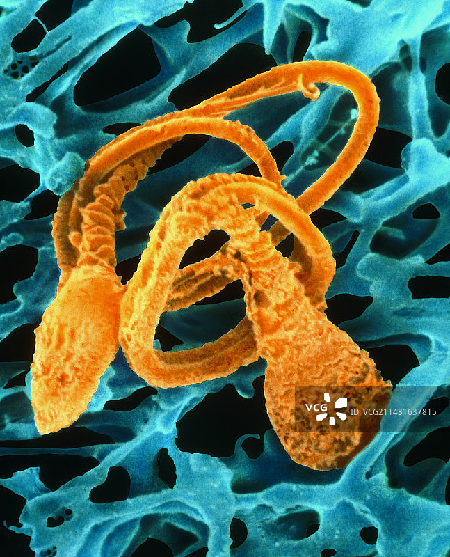 正在瓦解的人类精子的彩色扫描电镜图图片素材