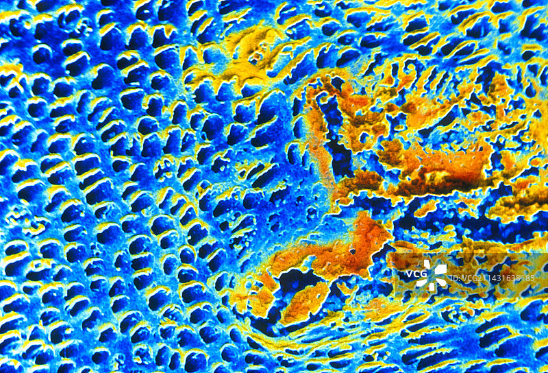 牙本质中龋齿的电子显微照片图片素材