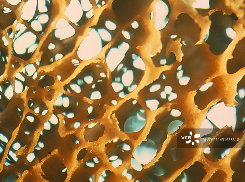 人类松质骨的微距照片图片素材