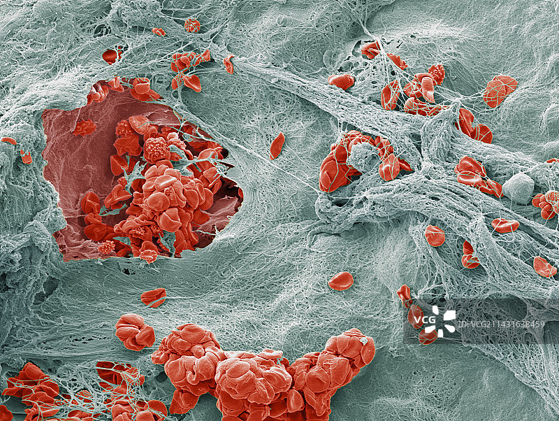 伤口愈合图片素材