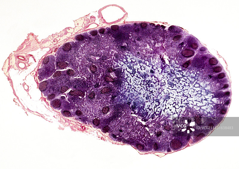 淋巴结显微照片图片素材