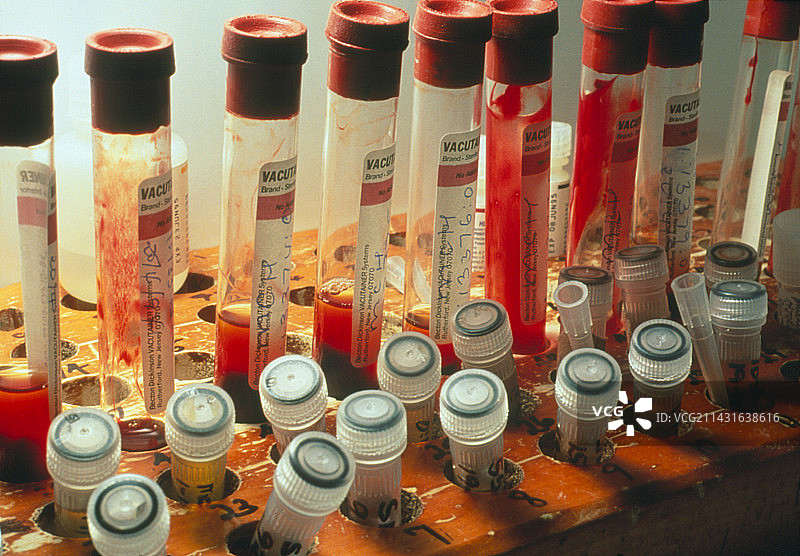 用于艾滋病研究的血液和血清样本架图片素材