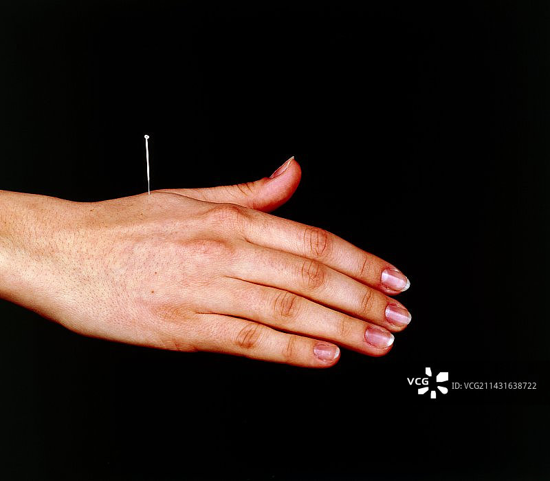 手部针灸图片素材