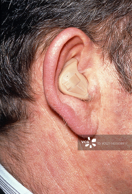 男子耳中的多通道自动助听器图片素材