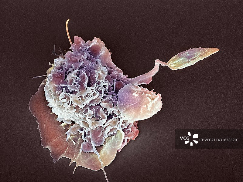 巨噬细胞攻击异物，扫描电镜图片素材