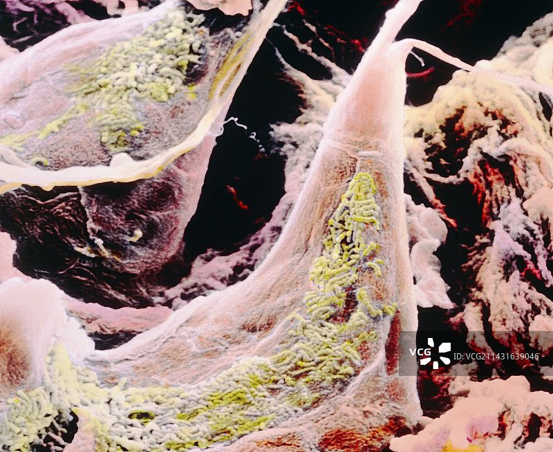 舌头丝状乳头的假彩色扫描电镜图图片素材