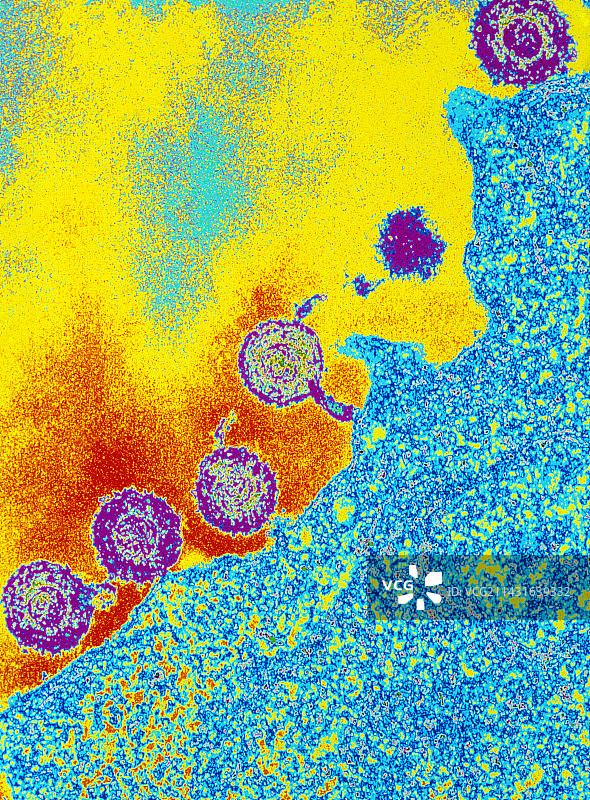 感染细胞的HHV6病毒彩色透射电镜图图片素材
