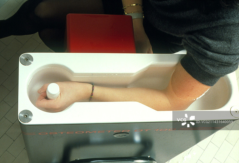女性手臂的骨密度扫描图片素材