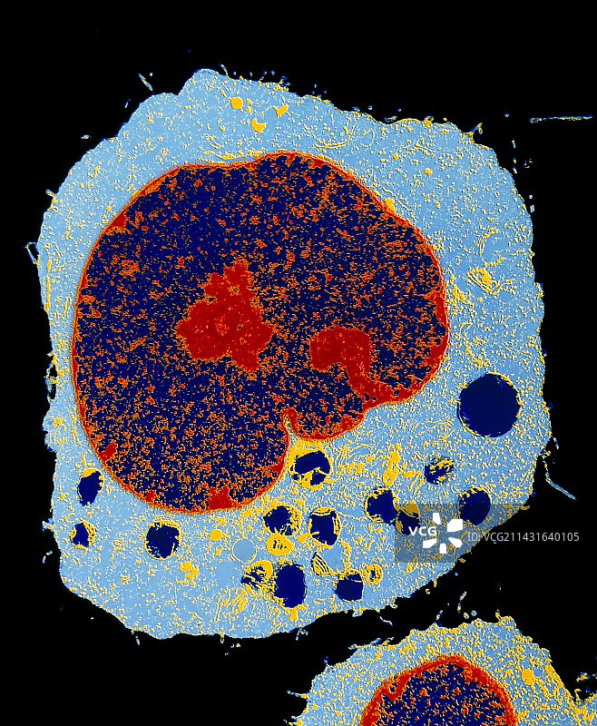 彩色透射电镜下的HeLa细胞切片图片素材