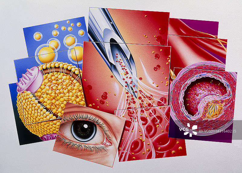 高胆固醇图片素材