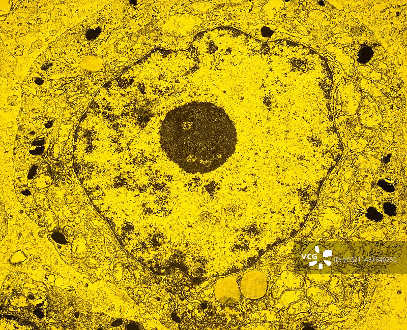 黑色素瘤恶性黑色素细胞的TEM图图片素材