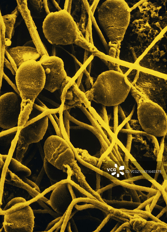 人类精子场的伪色彩扫描电镜图片素材