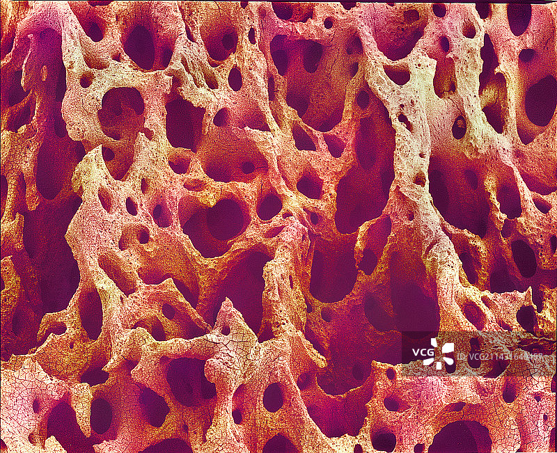 海绵骨，扫描电子显微镜图片素材
