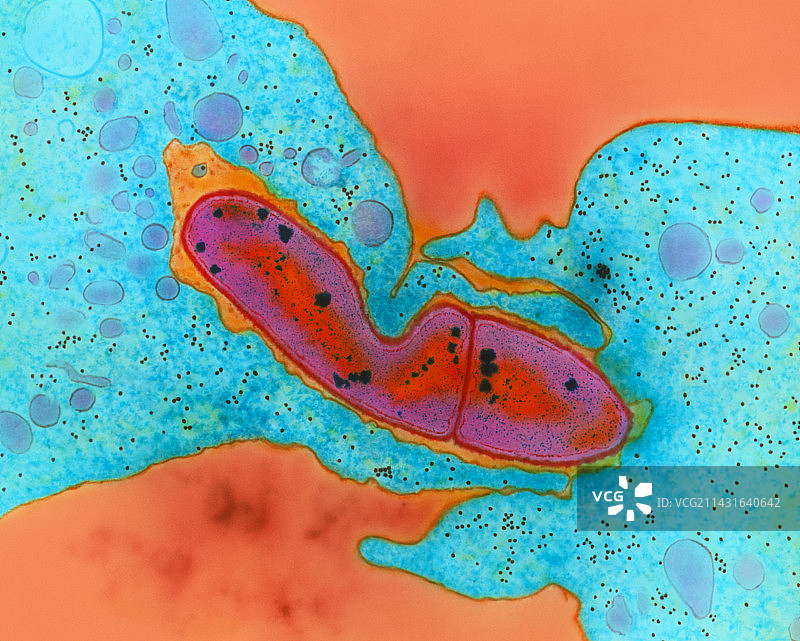 吞噬细菌的白细胞彩色透射电镜图图片素材