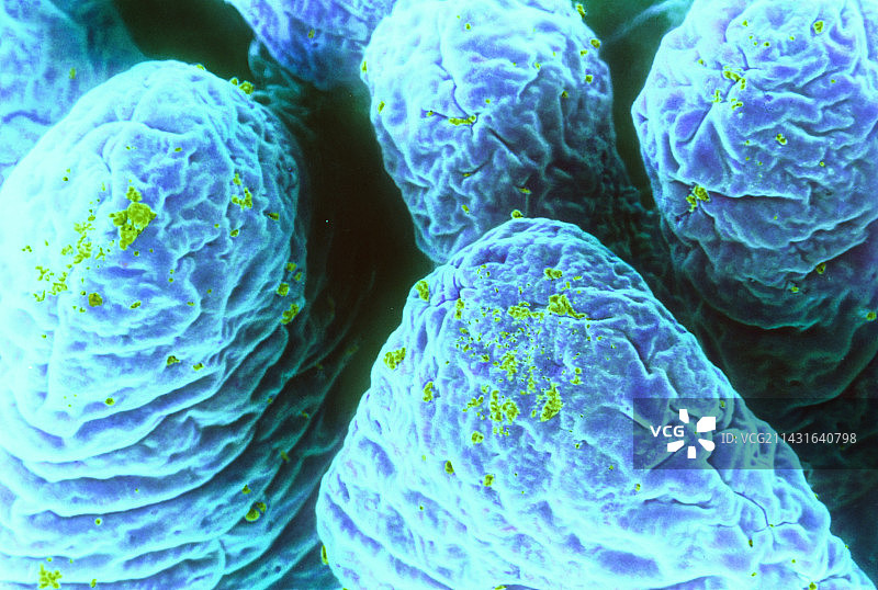 小肠绒毛的彩色扫描电镜图图片素材