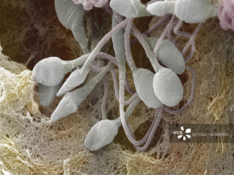 人类精子图片素材