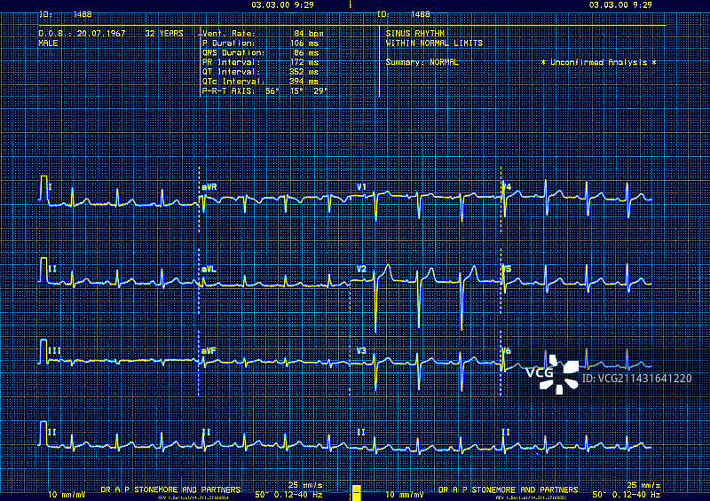 心电图图片素材