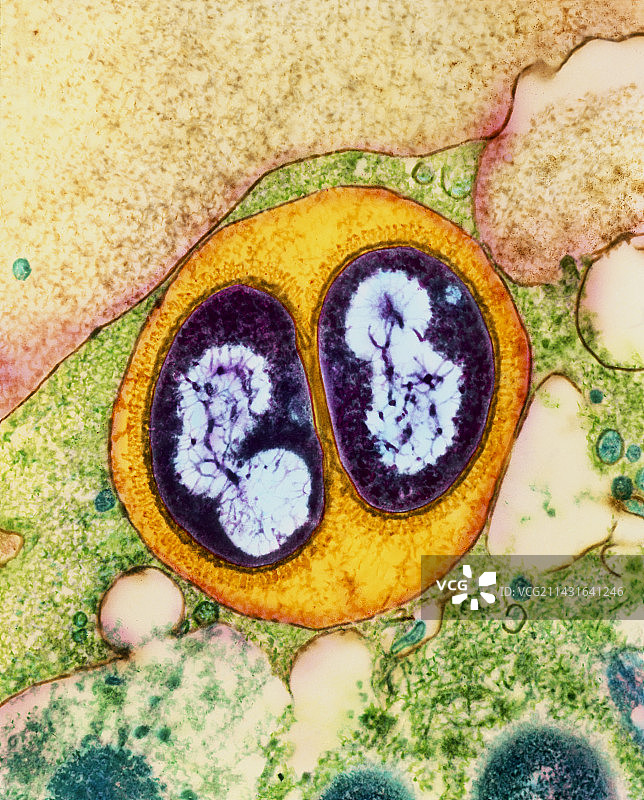 巨噬细胞中的嗜血杆菌图片素材