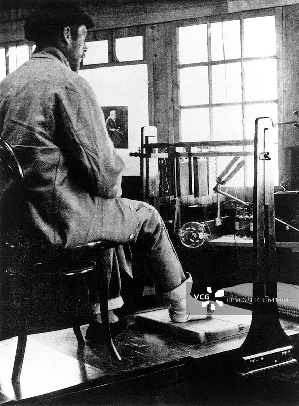 1899年布尔战争士兵受伤的脚的X光照片图片素材