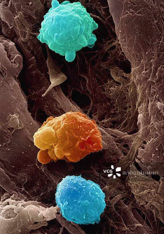 白血病血细胞图片素材