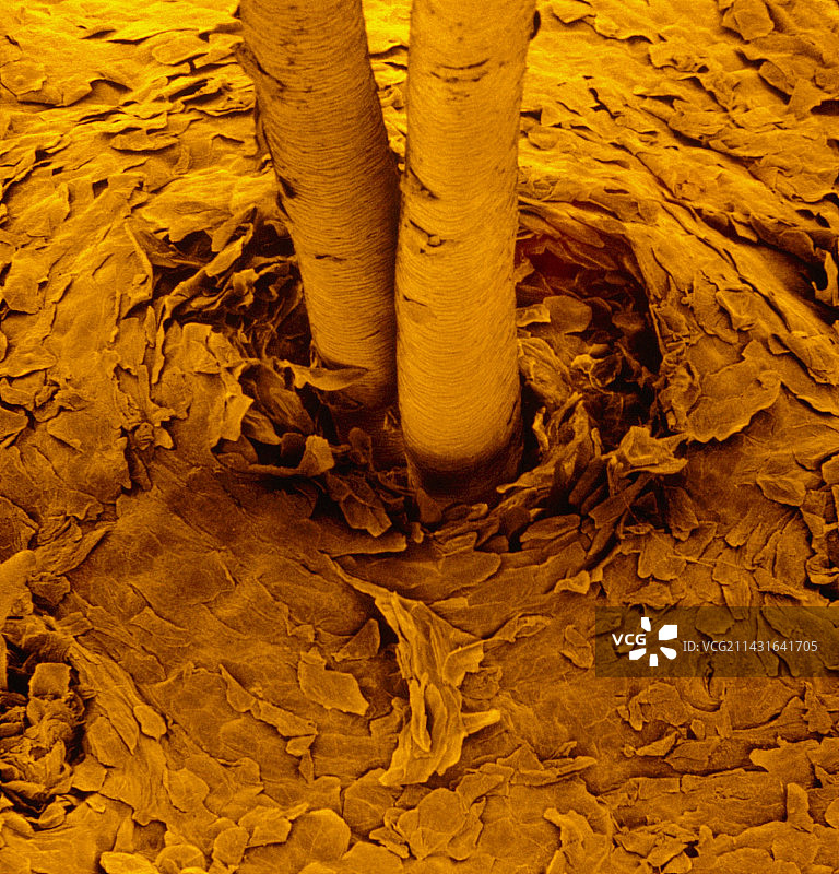 人头皮皮肤表面F的SEM图图片素材