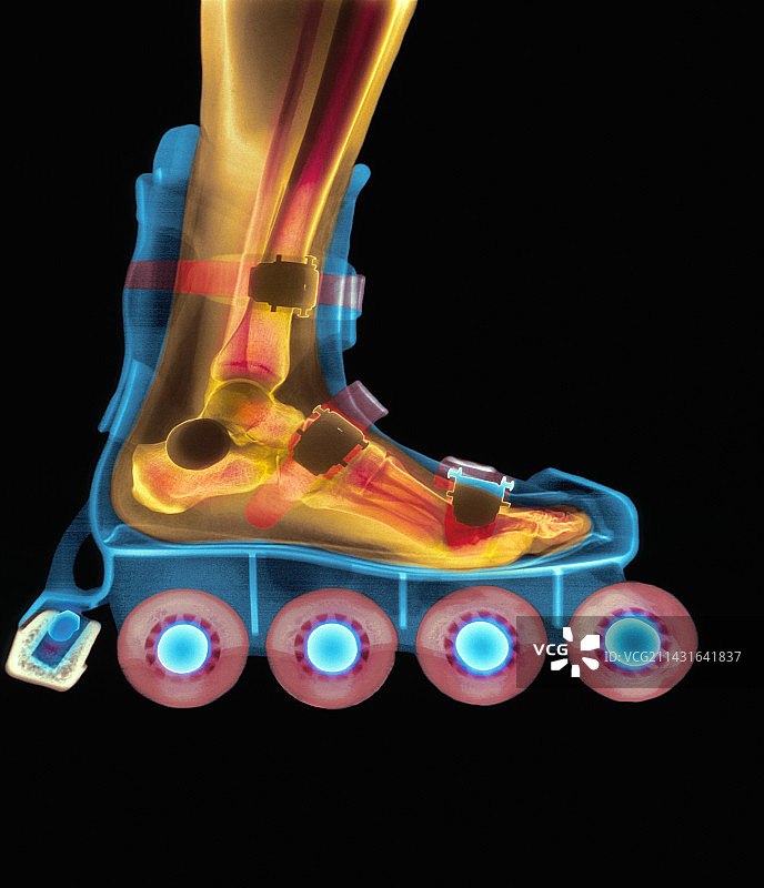 旱冰鞋中脚部的X射线图片素材