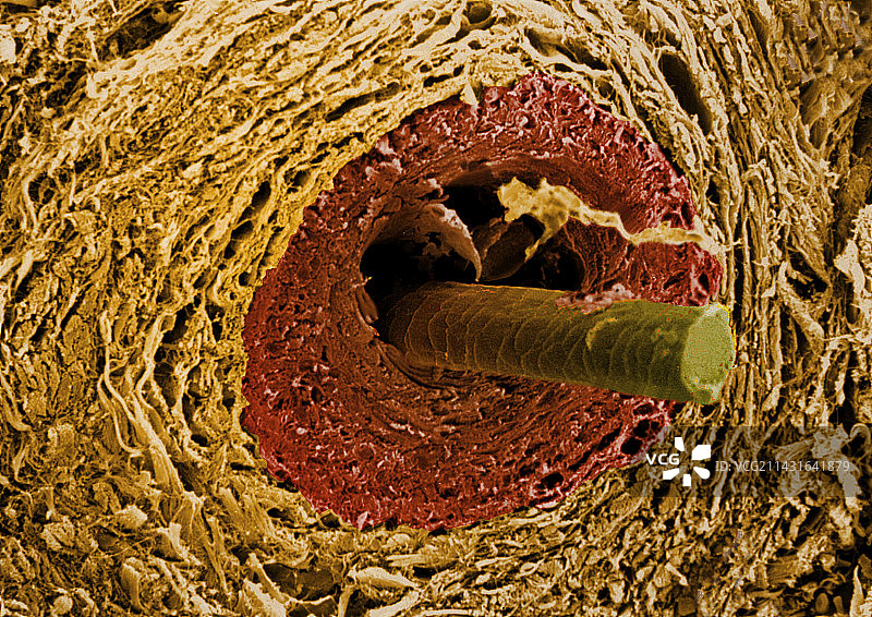 毛囊切面的彩色扫描电镜图像图片素材