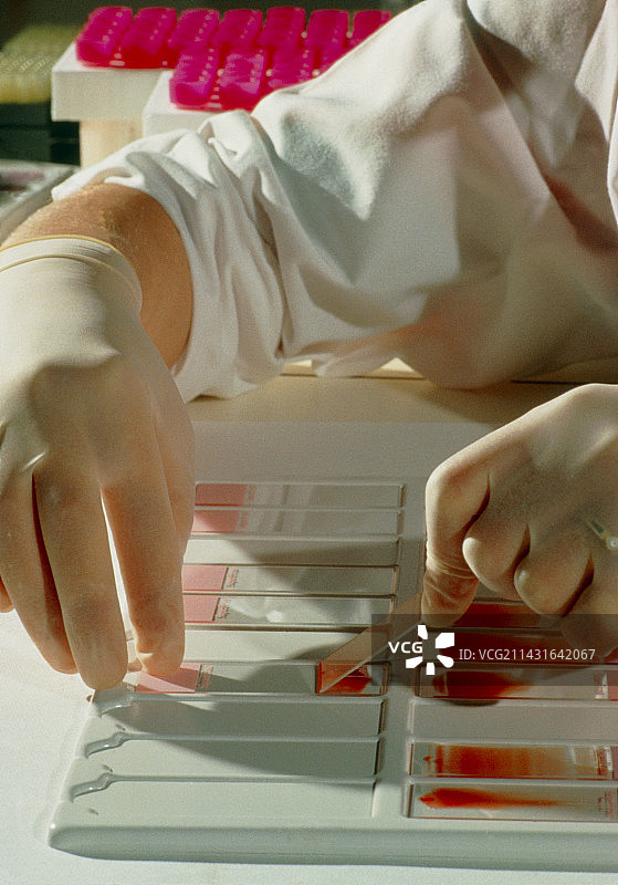 人类血涂片检测图片素材