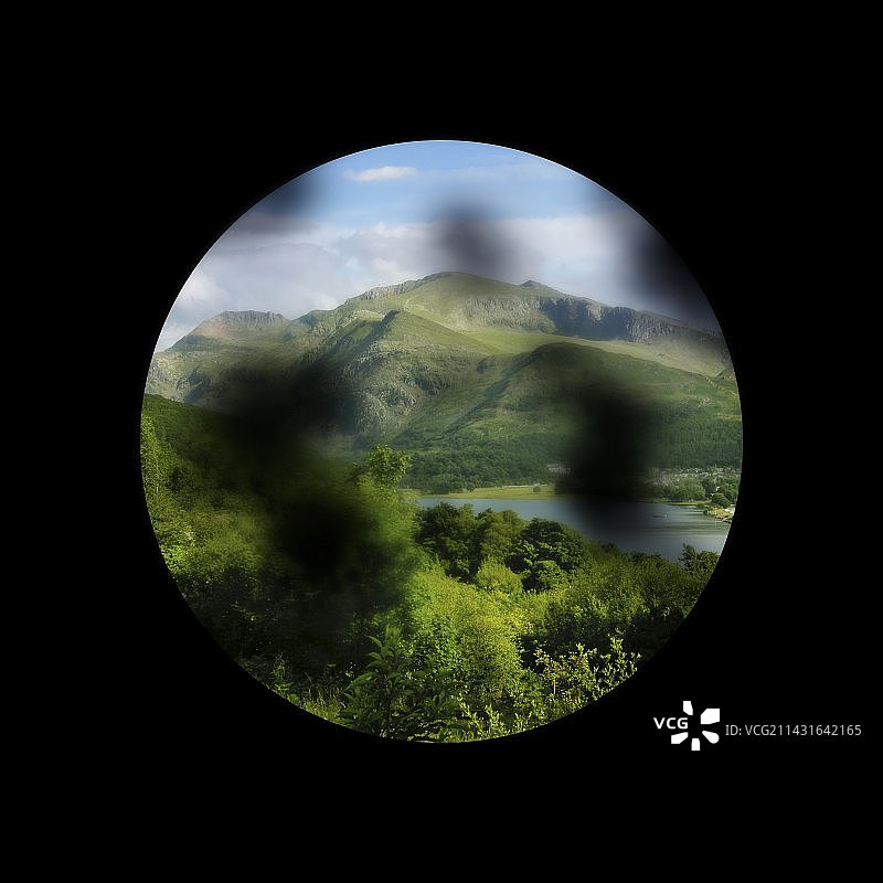 糖尿病视网膜病变图片素材