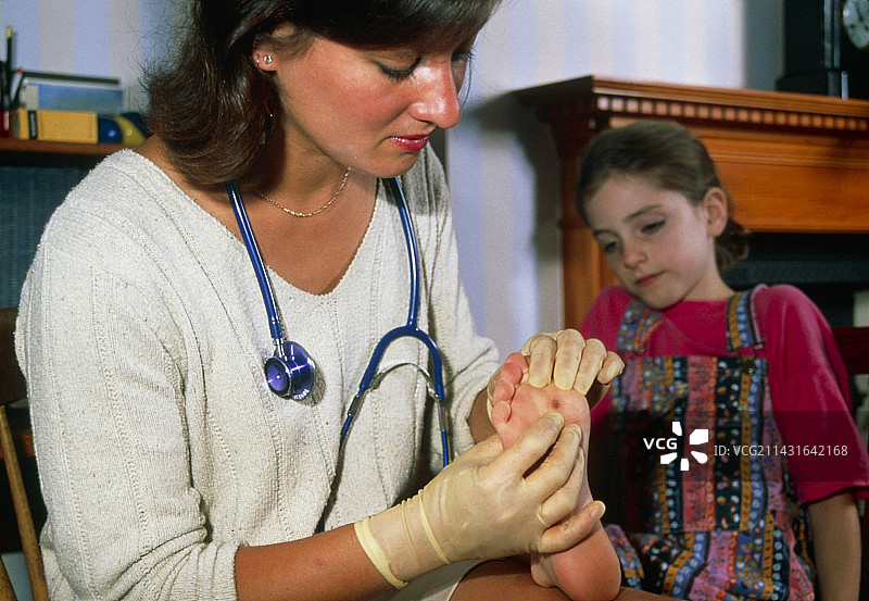 医生检查小女孩脚上的疣图片素材