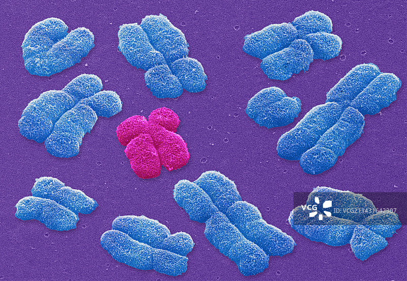 人类染色体，扫描电镜图图片素材