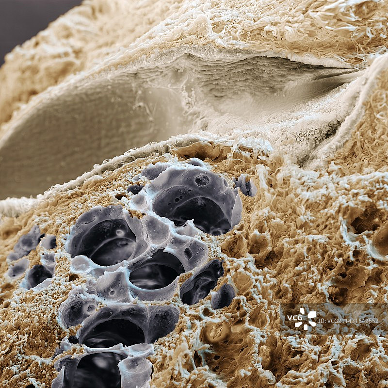 肺细支气管和肺泡扫描电镜图图片素材