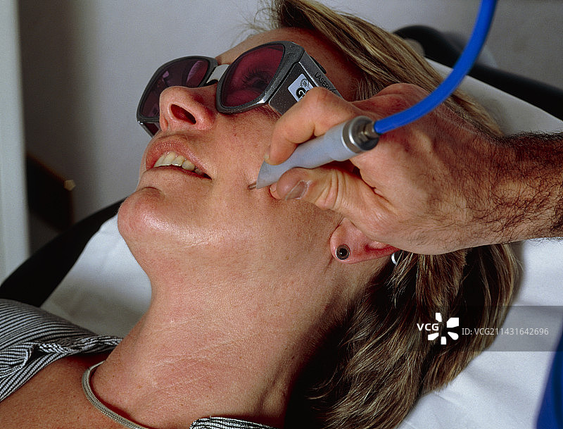 激光皮肤护理图片素材