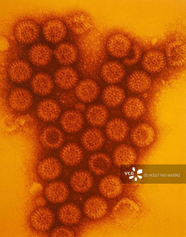 轮状病毒颗粒的透射电镜伪色图像图片素材