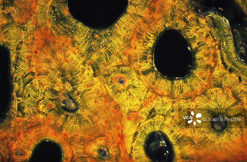 致密骨图片素材